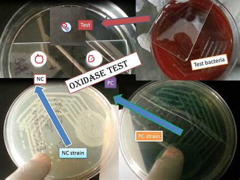 Oxidase Test.